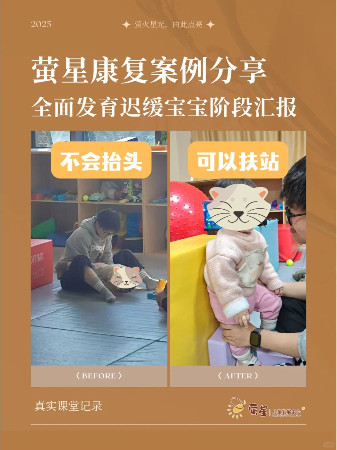 丈夫捐肝救妻 如今喜获“千金”